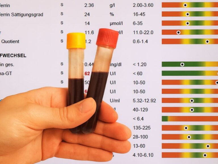 Eine Hand hält zwei Röhrchen mit Blutproben. Im Hintergrund sieht man eine Tabelle mit Auswertungen einer ganzheitlichen Laboruntersuchung.